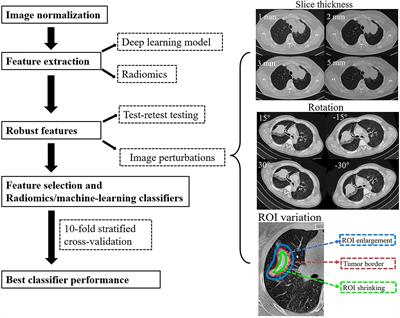 Assessing the robustness of radiomics/deep learning approach in the identification of efficacy of anti–PD-1 treatment in advanced or metastatic non-small cell lung carcinoma patients